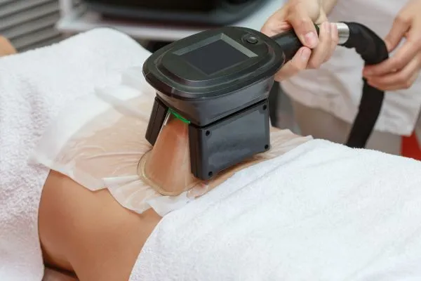 Image of person having fat freezing treatment to help weight gain Lancaster
