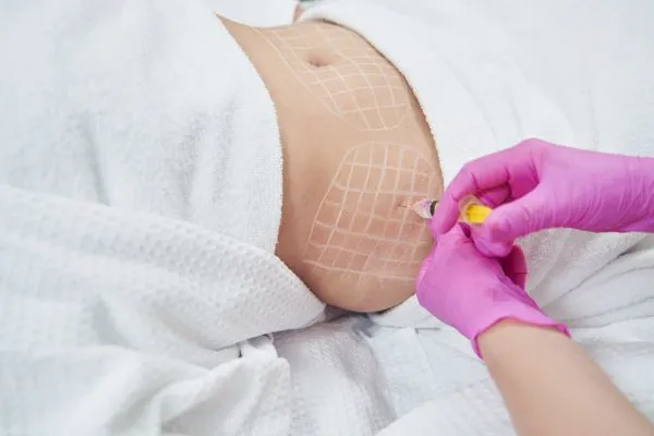 image of fat dissolving injections on love handles to help combat weight gain Lancaster