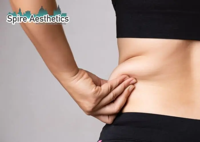 Image of woman pinching fat on their hips Lancaster. Fat Freezing treatment
