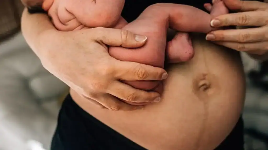 Why Is My Stomach Still Big After Pregnancy Lancaster?